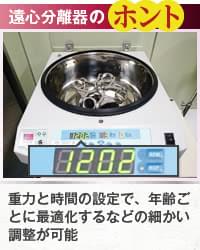 脂肪濃縮に必要な遠心分離器のホント