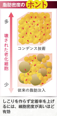 しこりを作らずに定着率を上げるには、細胞密度の高さが重要