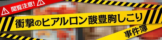 ヒアルロン酸豊胸で後悔するしこりの実態報告！回避策までを医師が解説