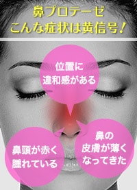 鼻プロテーゼの危険症状