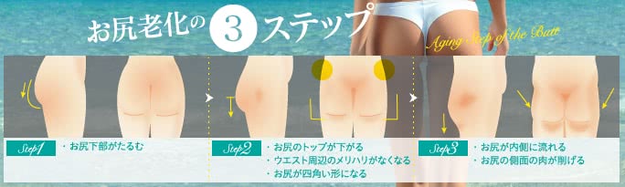 お尻の老化レベル
