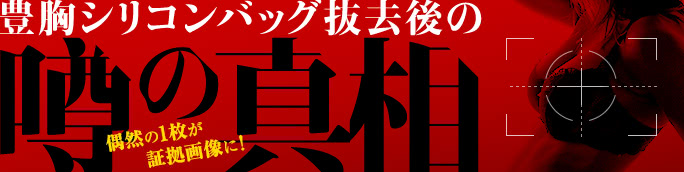 豊胸シリコンバッグ抜去後の噂の真相を解明