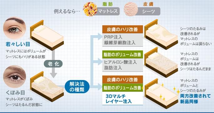 3Dマルチレイヤー注入で、脂肪の減少と老化を解決