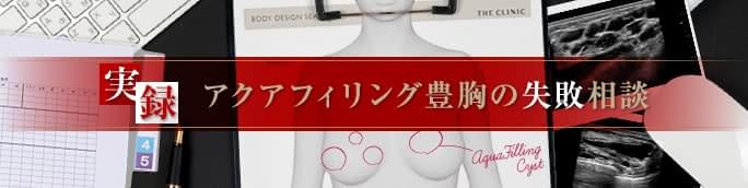 アクアフィリング豊胸の失敗事例【ジェル状充填剤の危険性】