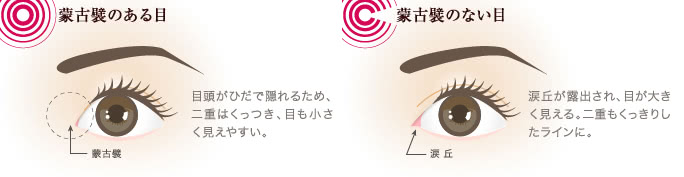 画像:蒙古襞のある目とない目の違い