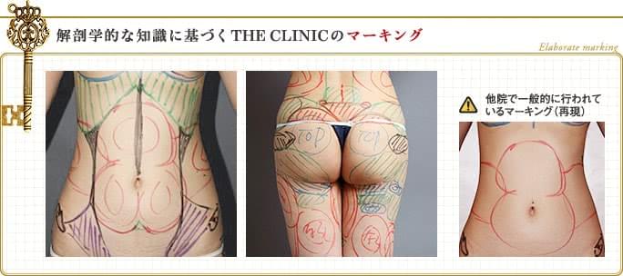 THE CLINIC の360°マーキング