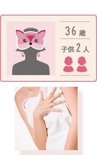 産後の豊胸:36歳/子供2人