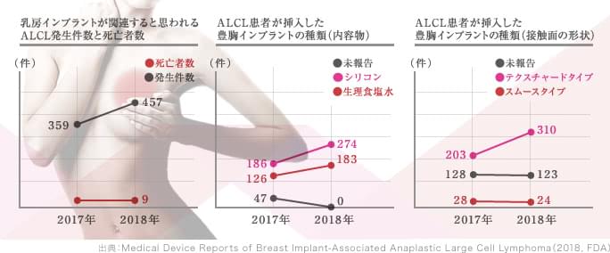 乳房インプラントとがんの関係性