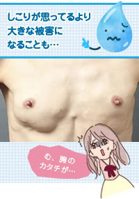 ヒアルロン酸豊胸によってできたしこり実例