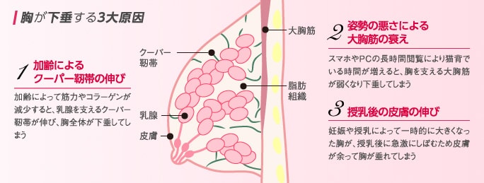 胸が下垂する3大原因