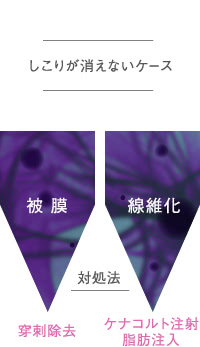 画像:しこりが消えない原因と対処法