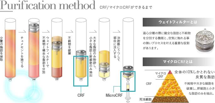 CRFおよびマイクロCRFの抽出過程