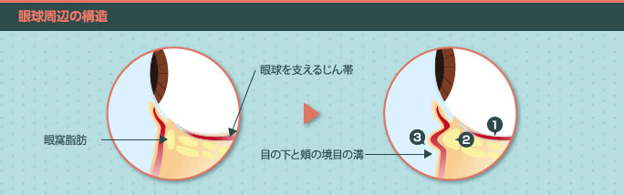 目の下のクマ・たるみの原因
