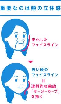 頬にも脂肪を注入することでほうれい線を根本改善