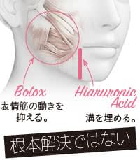 マリオネットラインの誤った改善方法