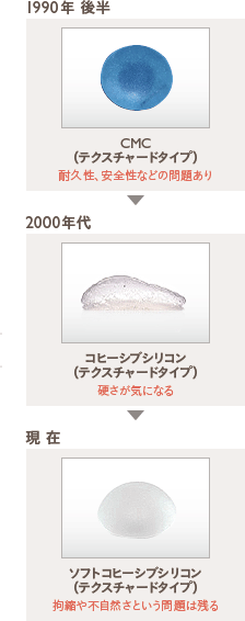 豊胸バッグの歴史:1990年後半〜現在