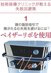 顔の脂肪吸引の失敗回避策1:ベイザーリポ