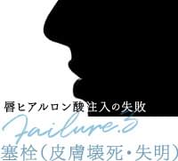 唇のヒアルロン酸注入の失敗（塞栓）