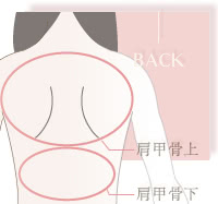 背中の脂肪吸引の費用の詳細
