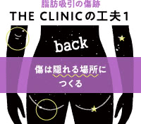 脂肪吸引の傷跡を目立たせないために、傷は小さく