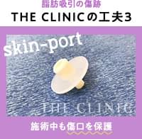 脂肪吸引の傷跡を目立たせないために、傷口を保護