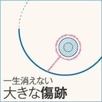 胸を切る乳房縮小術の懸念点③胸に大きな傷跡が残る