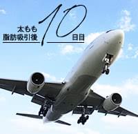 太もも脂肪吸引から10日後、旅行に