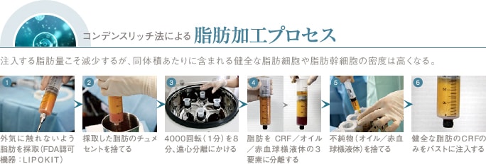 コンデンスリッチ法による脂肪加工プロセス