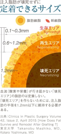注入脂肪が壊死せず定着できるサイズ