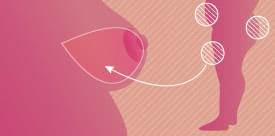 自己組織を移植する方法(穿通枝皮弁/筋皮弁による乳房再建)