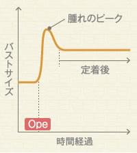 脂肪注入豊胸後のサイズ変化のイメージ