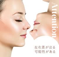 不均一のイメージ