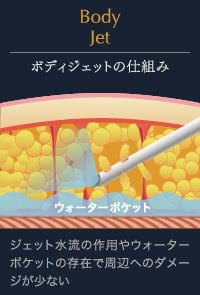 ボディジェットの仕組み | ジェット水流の作用やウォーターポケットの存在で周辺へのダメージが少ない