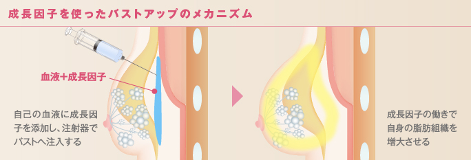 成長因子を使ったバストアップのメカニズム