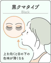 黒クマタイプ