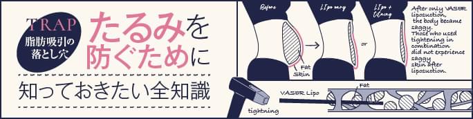 脂肪吸引の落とし穴｜たるみを防ぐために知っておきたい全知識
