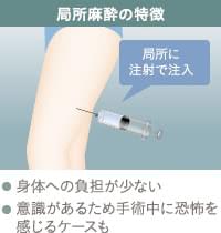 局所麻酔とは