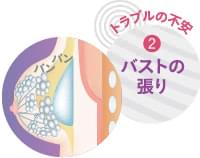 授乳後豊胸の不安2:バストの張り