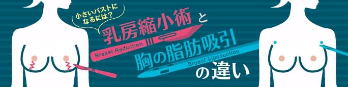 胸を小さくする手術【胸の脂肪吸引と乳房縮小術の違い】