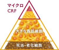 マイクロCRFについて