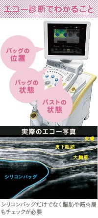 シリコンバッグ抜去前のエコー診断でわかること