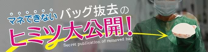 豊胸シリコンバッグ抜去のヒミツを公開
