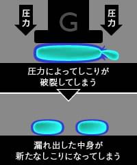 マンモグラフィー検査で胸のしこりが分裂する理由