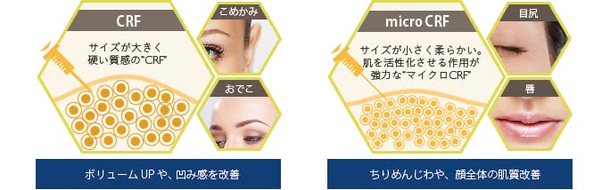 CRF、マイクロCRFの効果と適応部位