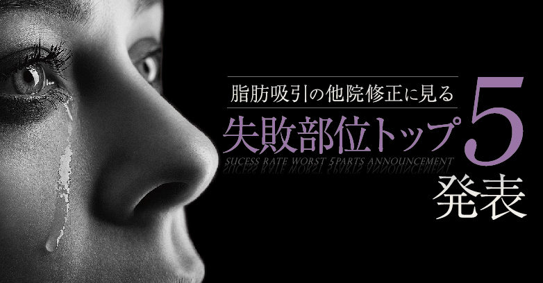 脂肪吸引でよくある5つの失敗例とその原因、修正方法