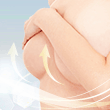 アンダーブーブ豊胸(下乳形成)