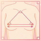 胸の左右差・垂れ・離れ感 正す三角形の豊胸術
