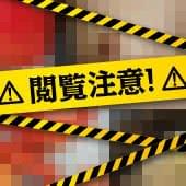 ヒアルロン酸豊胸で後悔するしこりの実態報告！回避策までを医師が解説