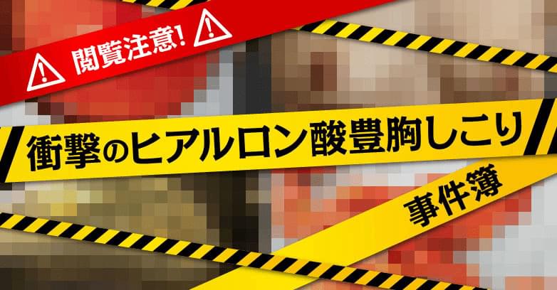 閲覧注意 衝撃のヒアルロン酸豊胸しこり事件簿 美容外科の医師監修コラム