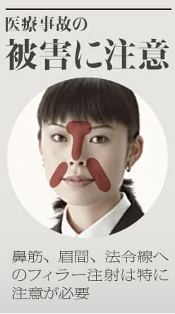 ヒアルロン酸やレディエッセで失明 フィラー注射の危険性 美容外科の医師監修コラム